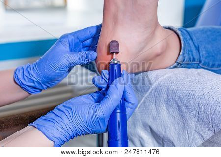 Master During A Pedicure. The Process Of Professional Pedicures. The Wizard In The Mask Causes The G