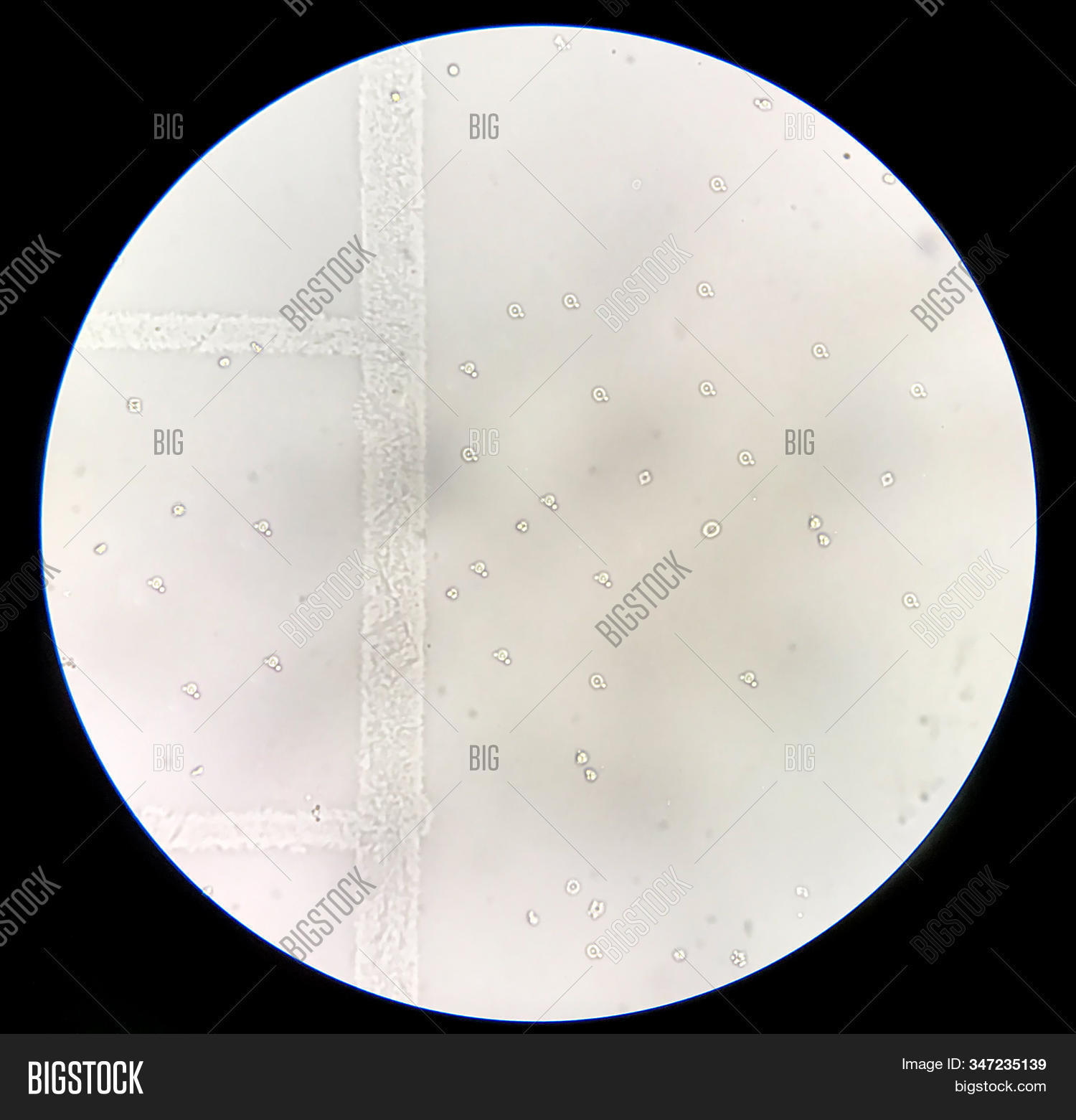 Moderate Dysmorphic Image & Photo (Free Trial) | Bigstock