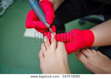 Podiatrist Treating Toenail Fungus. Podology Treatment. Close-up.
