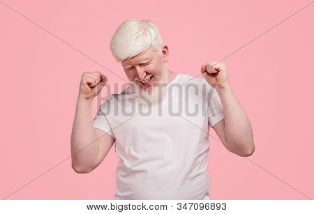 Excited Satisfied Adult Bearded Male With Albinism Wearing White T Shirt Celebrating Success And Vic