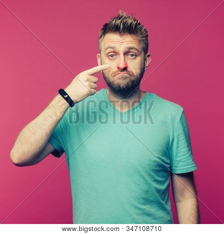 Sick Guy Isolated Has Runny Nose. Man Makes A Cure For The Common Cold From The Air Conditioner. Poi