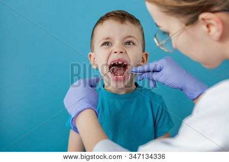 Dentist Examining Boys Teeth On Blue Background. A Small Patient In The Dental Chair Smiles. Dantist