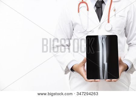 Doctor Holding Tablet Computer With X Ray Film