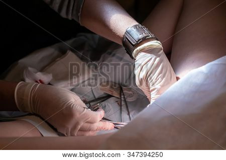 Hands Of A Doctor Are Seen At Work For A Woman Who Just Gave Birth, Wearing Latex Clothes Using Ster