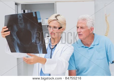 Female doctor and senior patient examining x-ray in clinic