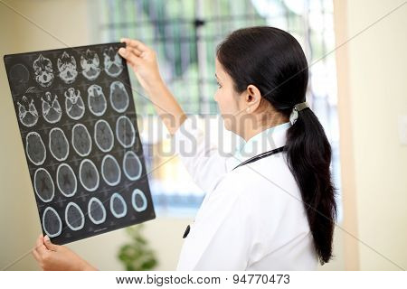Female Doctor Examining A Brain Computerized Tomography Scan