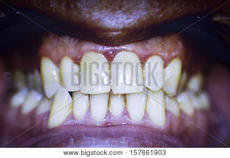Dentists Dental Teeth Photo