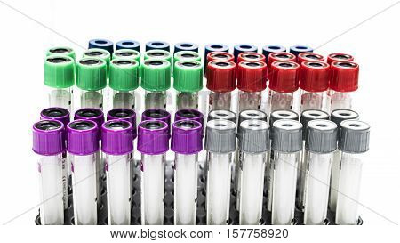 Colorful laboratory tube on the rack in the laboratory room.
