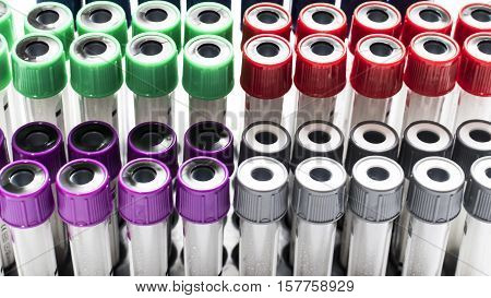 Colorful laboratory tube on the rack in the laboratory room.