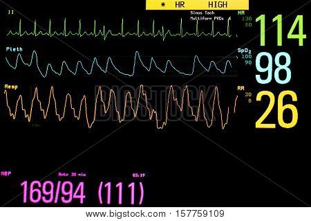 Vital signs monitoring in the ICU unit.