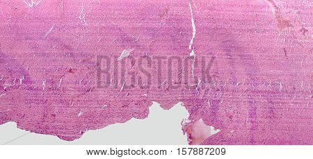 Heart Micrography