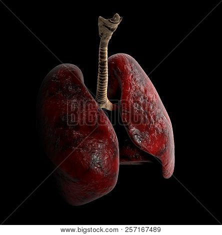 Human Lung Anatomy, 3d Illustration On Black Background