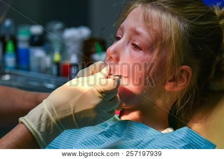 A Little Girl At The Dentist Is Crying With Tears At A Doctor's Appointment While Treating A Tooth.