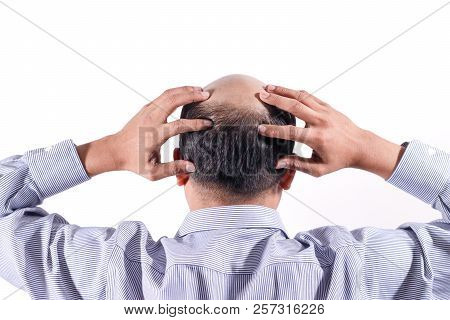 Bald Businessman With His Head On Scalp View From Behind With White Background