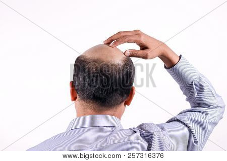 Bald Businessman With His Head On Scalp View From Behind With White Background