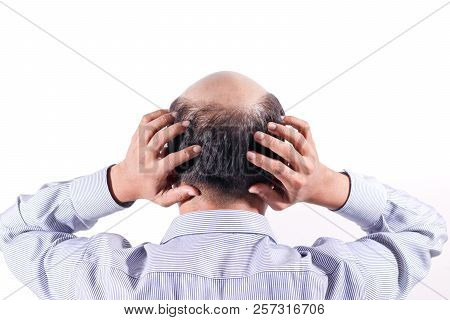 Bald Businessman With His Head On Scalp View From Behind With White Background