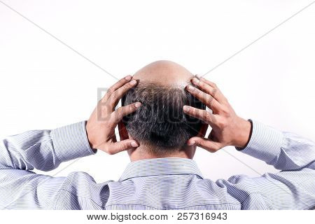 Bald Businessman With His Head On Scalp View From Behind With White Background
