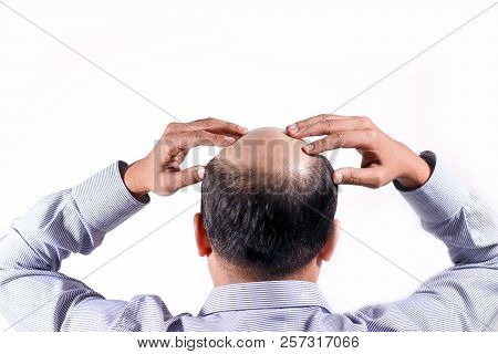 Bald Businessman With His Head On Scalp View From Behind With White Background