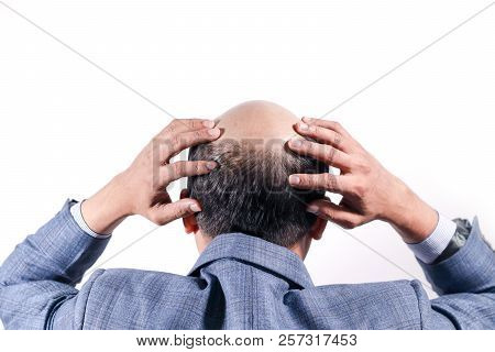 Bald Businessman With His Head On Scalp View From Behind With White Background