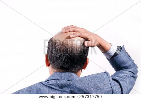 Bald Businessman With His Head On Scalp View From Behind With White Background