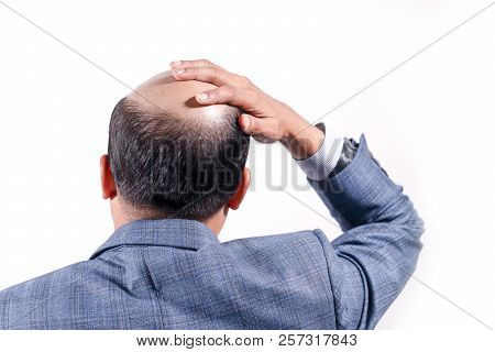 Bald Businessman With His Head On Scalp View From Behind With White Background