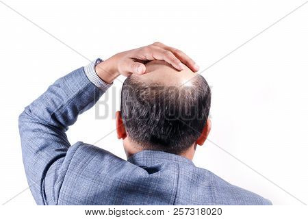Bald Businessman With His Head On Scalp View From Behind With White Background