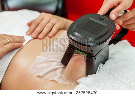 Woman Getting Cryolipolysis Fat Treatment Procedure In Professional Cosmetic Cabinet Or Spa Center