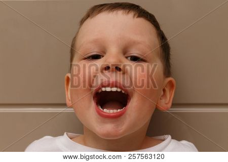 Boy, Child, In A White T-shirt Opened His Mouth On Examination With A Doctor. A Dentist Or An Otolar