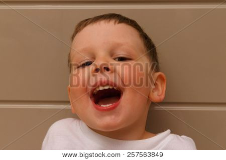Boy, Child, In A White T-shirt Opened His Mouth On Examination With A Doctor. A Dentist Or An Otolar
