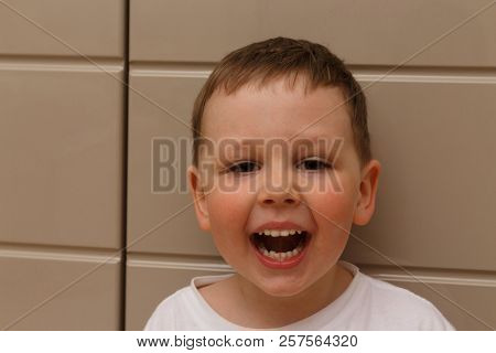 Boy, Child, In A White T-shirt Opened His Mouth On Examination With A Doctor. A Dentist Or An Otolar