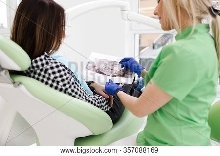 Dental Clinic Doctor Shows A Panoramic X-ray Picture To His Patient. Doctor Explains To Her Patient 