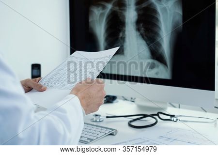 closeup of a young doctor man, wearing a white coat, sitting at his desk checking the results of a test and a chest radiograph in his computer