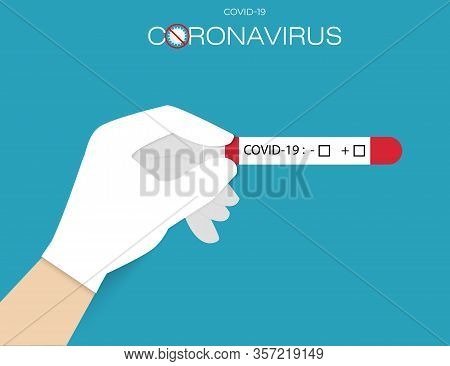 Doctors Hand Holds Test Tube With Blood For 2019-ncov Analyzing. Novel Chinese Coronavirus Blood Tes