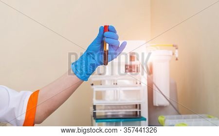 Hands Of Laboratory Assistant In Gloves Analyzing Blood Sample. Prevention. Pneumonia Diagnosing. Co