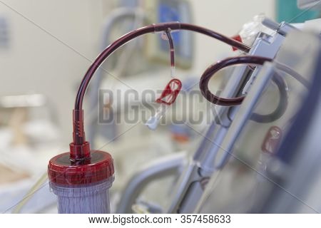 Dialyzer With Upper Port, On Backgroud Dialysis Machine In Icu In Hospital