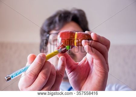 Doctor On Defocused Background Holds In His Hand Anatomic Model Of Gallbladder And Liver, Pointing W