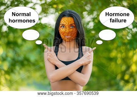 Young Girl With Orange Peel Skin, Bad Skin Sign, Shows The Words 