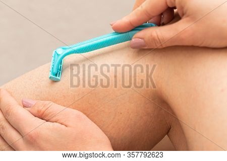 Close Up Picture Of Woman Holding Razor, Shaving Her Hairy Leg With Folliculitis