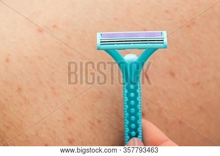 Close Up Picture Of Woman Holding Razor, Shaving Her Hairy Leg With Folliculitis