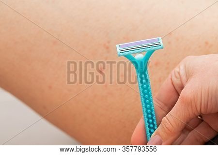 Close Up Picture Of Woman Holding Razor, Shaving Her Hairy Leg With Folliculitis