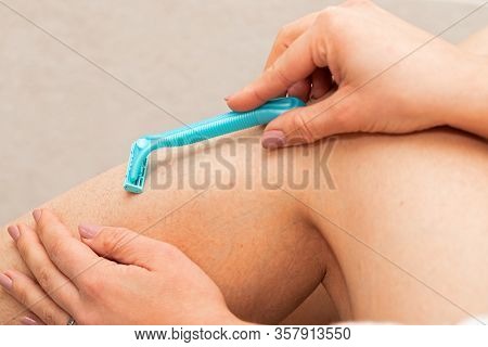 Close Up Picture Of Woman Holding Razor, Shaving Her Hairy Leg With Folliculitis