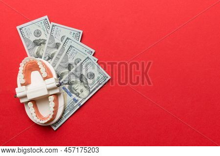 Closeup Model Of A Human Jaw With White Teeth And Dollar Bill. Dentistry Conceptual Photo. Prostheti