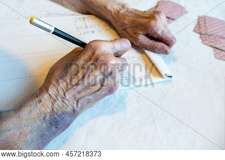 A Bruise After An Unsuccessful Fall On The Hands Of An Elderly Man. Old Age. Wrinkled Skin. An Elder