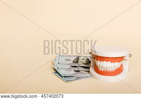 Closeup Model Of A Human Jaw With White Teeth And Dollar Bill. Dentistry Conceptual Photo. Prostheti