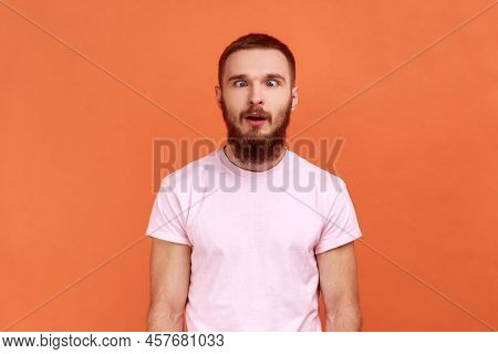 Portrait Of Bearded Man Looking Cross-eyed With Stupid Smile, Fooling Around, Making Silly Face, Bra