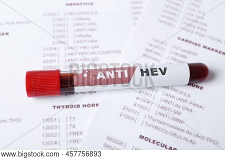 Tube With Blood Sample And Label Anti Hev On Laboratory Test Form, Closeup