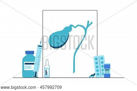 Gallbladder Anatomical Poster Or Banner For Education. Scheme Of Biliary Ducts. Part Of The Digestiv