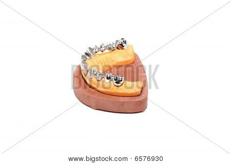 Dental Gips Formen, Zahnersatz