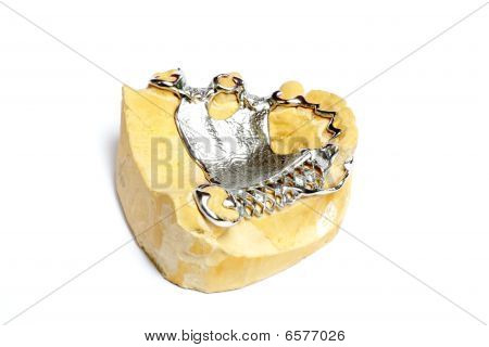 Dental Gips Formen, Zahnersatz