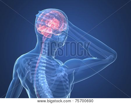 headache illustration